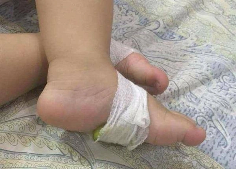 Cách hạ sốt cho bé bằng chanh