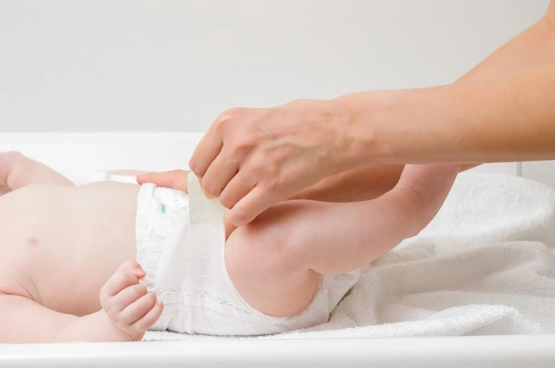 mụn sữa ở bé sơ sinh