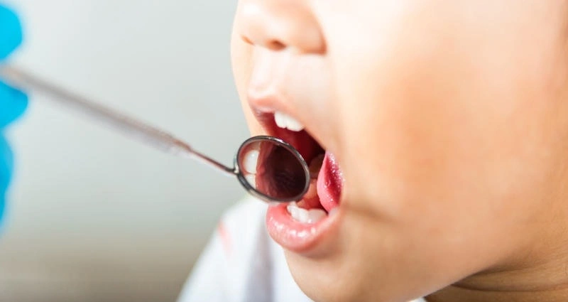 Mẹo chữa nghiến răng khi ngủ ở trẻ em