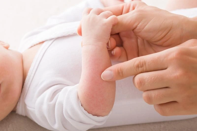 trẻ sơ sinh bị nổi mẫn đỏ